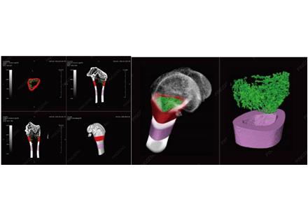 顯微CT（Micro-CT）